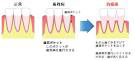 歯周病の治療